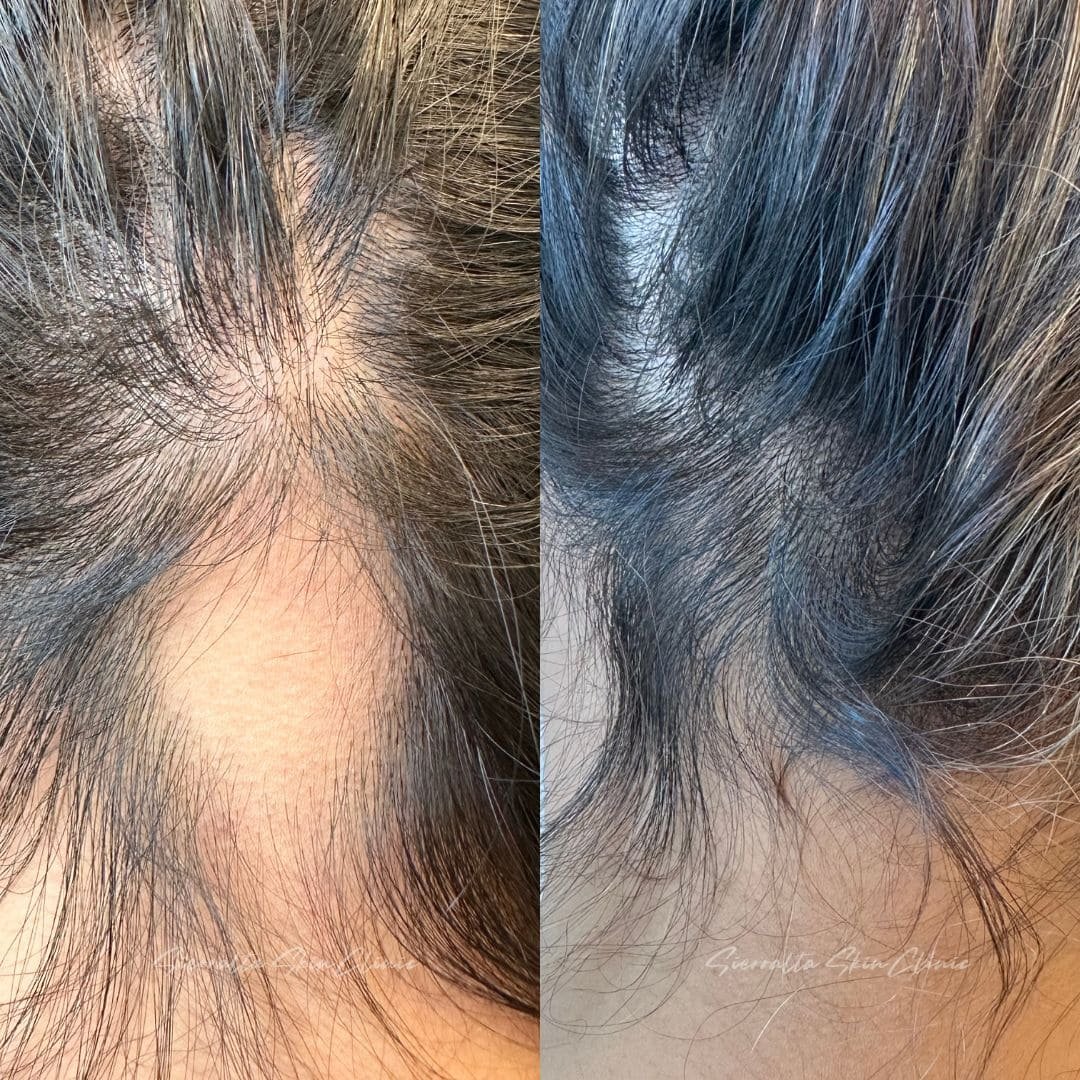 KIT COMPLETO - Imagen 3