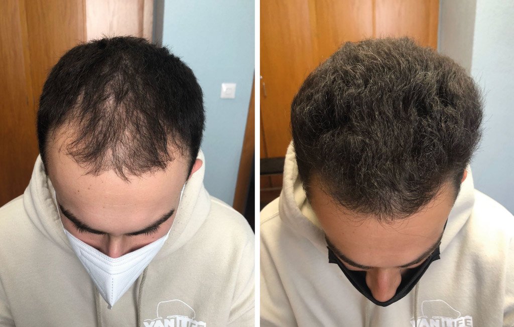 KIT COMPLETO - Imagen 5